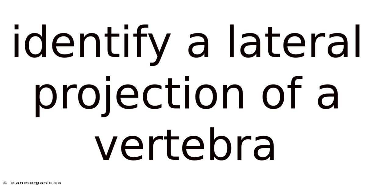 Identify A Lateral Projection Of A Vertebra