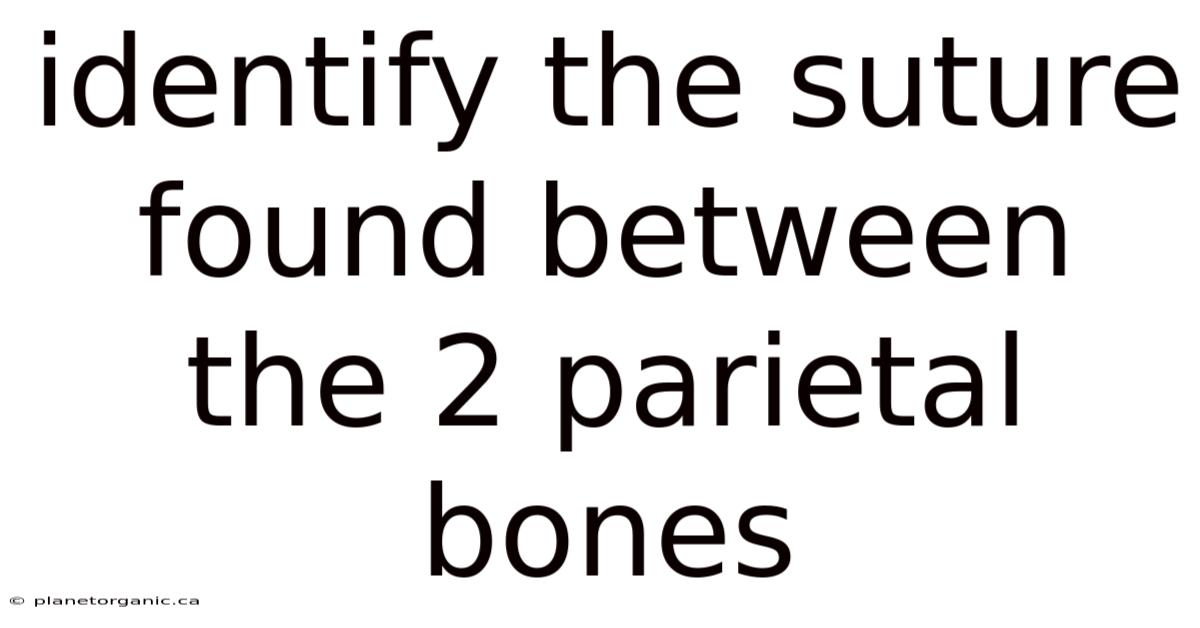 Identify The Suture Found Between The 2 Parietal Bones