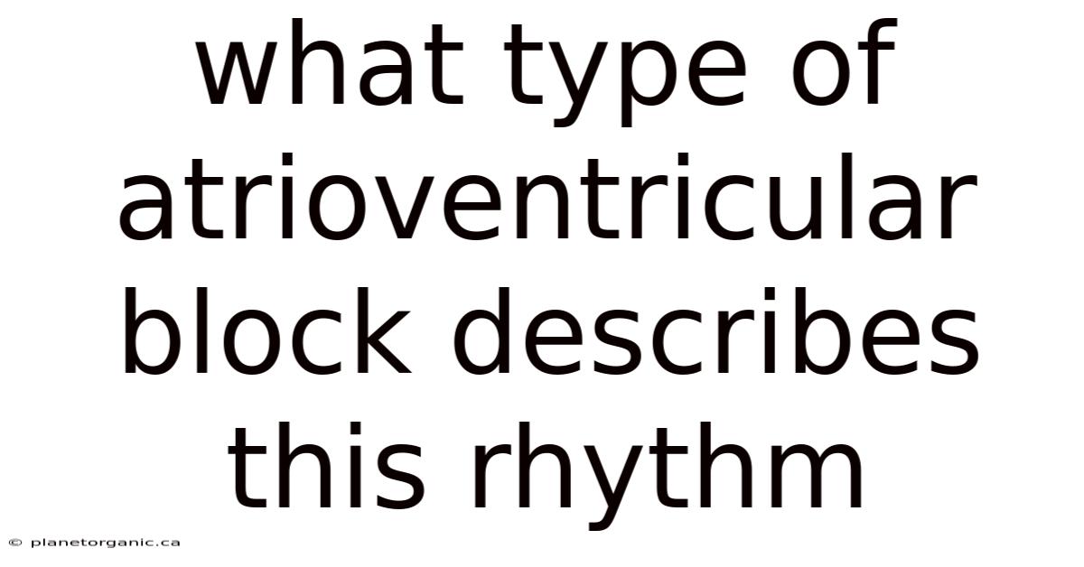 What Type Of Atrioventricular Block Describes This Rhythm